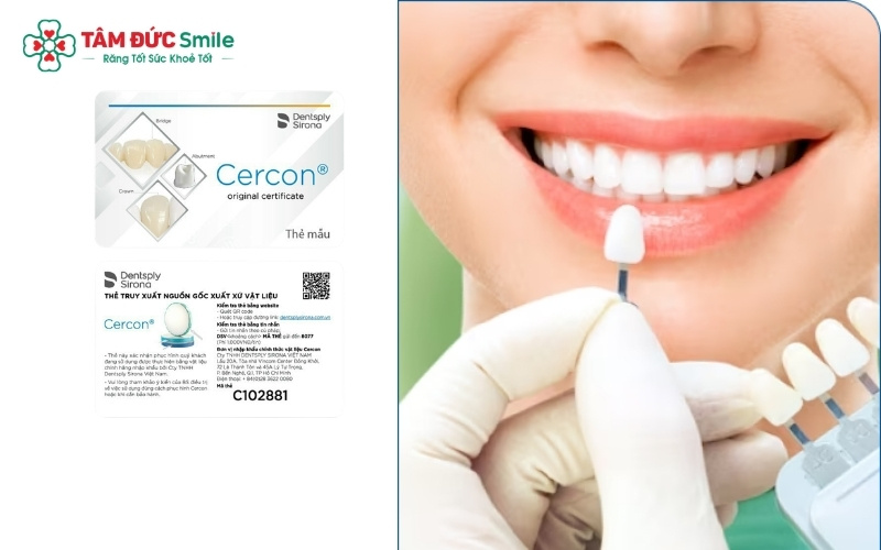 Răng sứ Cercon HT không chỉ sở hữu độ thẩm mỹ vượt trội mà còn có thời gian bảo hành chính hãng lên đến 10 năm tại các nha khoa uy tín.