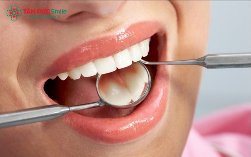 Thẻ bảo hành có hiệu lực khi thông tin trên thẻ trùng khớp với hồ sơ điều trị và khách hàng tuân thủ lịch tái khám định kỳ.