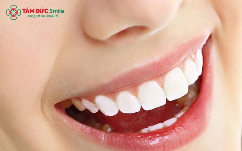 Bảo hành có hiệu lực đối với các lỗi kỹ thuật về độ bền và màu sắc của sứ trong quá trình sử dụng.