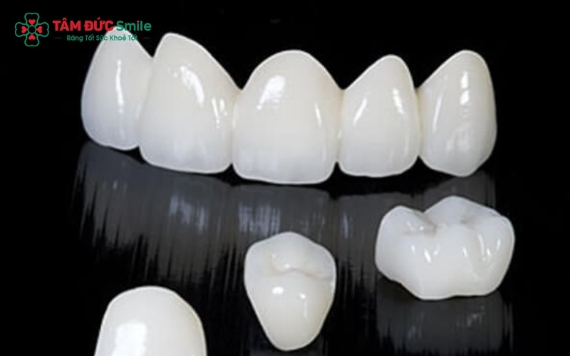 Lưu ý các trường hợp răng vỡ do tác động ngoại lực hoặc thói quen xấu sẽ không được áp dụng chính sách bảo hành.