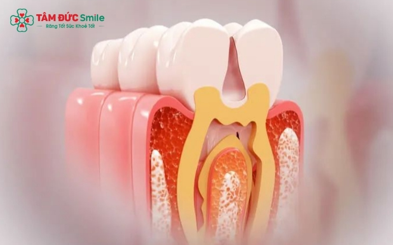 Tiêu xương hàm không chỉ ảnh hưởng đến chức năng nhai mà còn gây lão hóa sớm, khiến khuôn mặt bị biến dạng và già hơn tuổi thật.