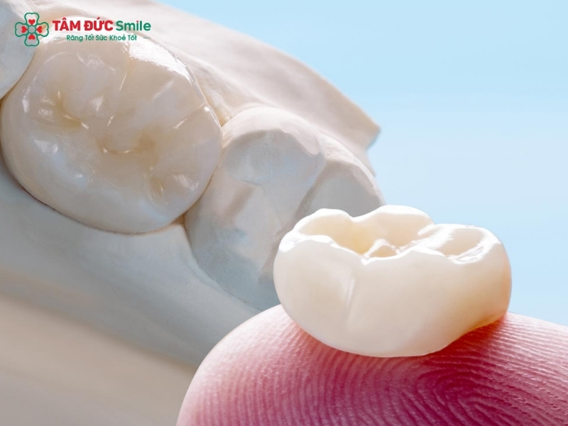 Tuổi thọ răng sứ zirconia bao lâu? Cách kéo dài tuổi thọ răng sứ Zirconia