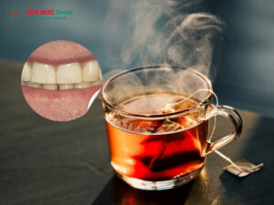 Uống trà có làm vàng răng không? Cách để hạn chế vàng răng khi uống trà