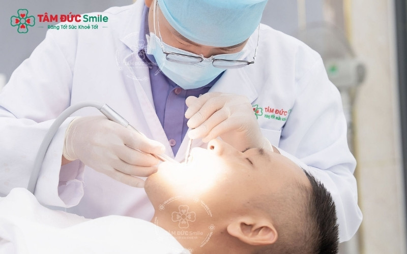 Việc bơm rửa và làm sạch túi lợi bị viêm là bước điều trị đầu tiên quan trọng trước khi bác sĩ có chỉ định cắt lợi trùm hoặc nhổ bỏ răng khôn.