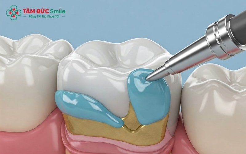Tiêu chí quan trọng của xi măng chất lượng là màu sắc ổn định và dễ dàng vệ sinh sau khi dán.