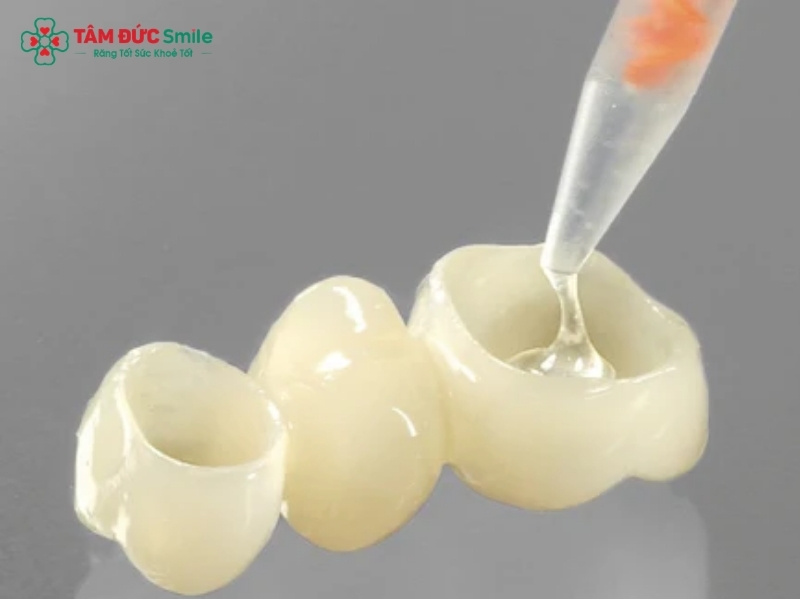 Xi măng dán răng sứ là gì? Các dòng xi măng dán răng sứ phổ biến hiện nay