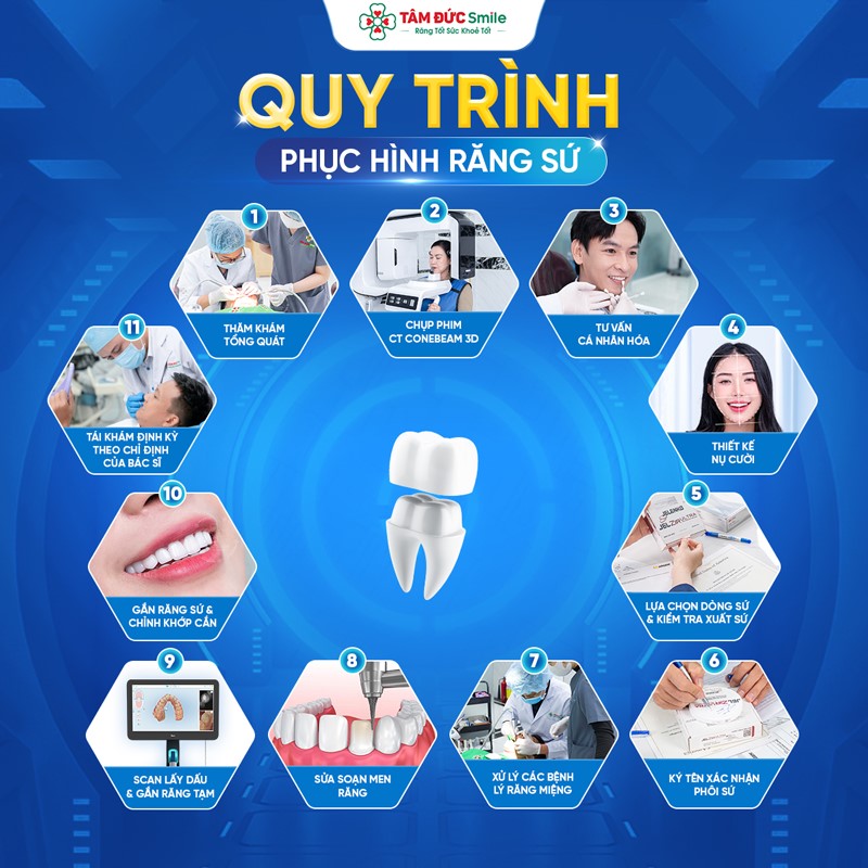 Quy trình bọc sứ tại Nha khoa Tâm Đức Smile gồm thăm khám, điều trị bệnh lý nếu có, mài chỉnh răng, scan lấy dấu, chế tác và gắn mão sứ hoàn thiện.