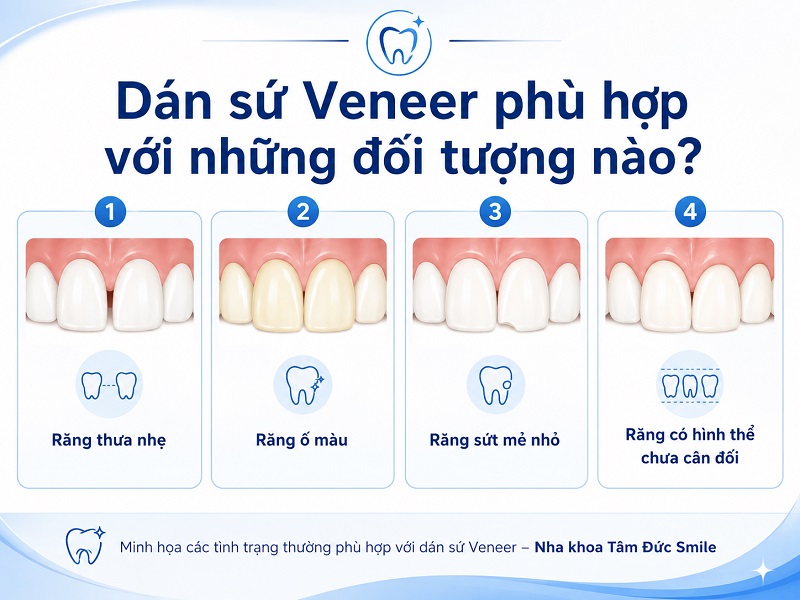 Dán sứ Veneer phù hợp với răng thưa nhẹ, ố màu, mẻ nhỏ nhưng cần được bác sĩ kiểm tra men răng và khớp cắn