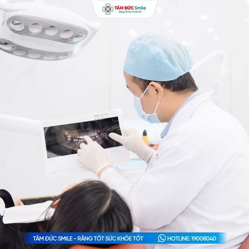 Chụp CT Cone Beam 3D giúp bác sĩ đánh giá cấu trúc xương và lập kế hoạch đặt 6 trụ Implant phù hợp.