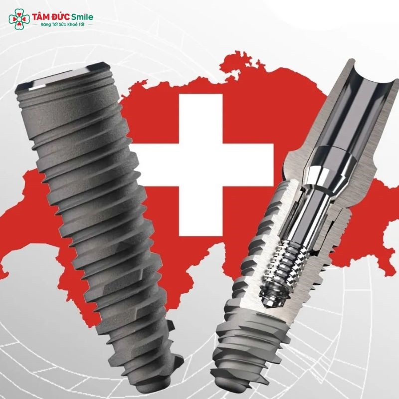 tru-implant-jupiter-5