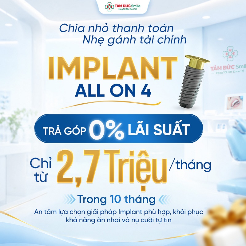 Chính sách trả góp